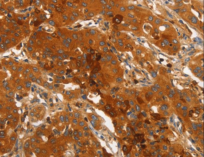 IHC-plus™ ORM2 / Orosomucoid 2 Antibody