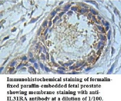 Polyclonal Rabbit anti-Human IL31RA Antibody (aa91-378, IHC, WB)