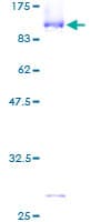 Human CBFA2T2 / MTGR1 Protein (Recombinant GST)