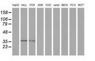 ANXA3 / Annexin A3 Antibody (clone OTI8A12)