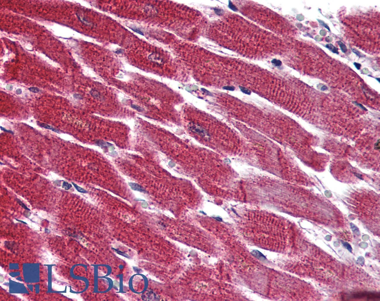 IHC-plus™ Polyclonal Rabbit anti-Human SIPR3 / EDG3 / S1P3 Antibody (N-Terminus, IHC)