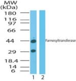 IHC-plus™ PTAR2 / FNTA Antibody (aa150-250)