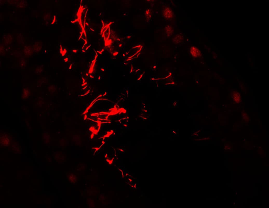AKAP82 / AKAP4 Antibody