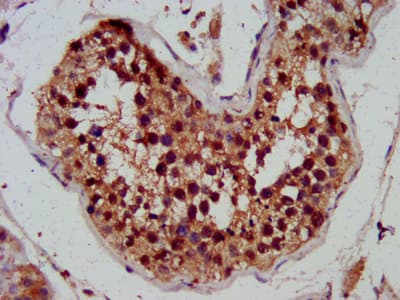 RAMA1 / SKA3 Antibody