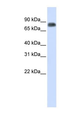 Polyclonal Rabbit anti-Human MST1 Antibody (aa540-589, IHC, WB)
