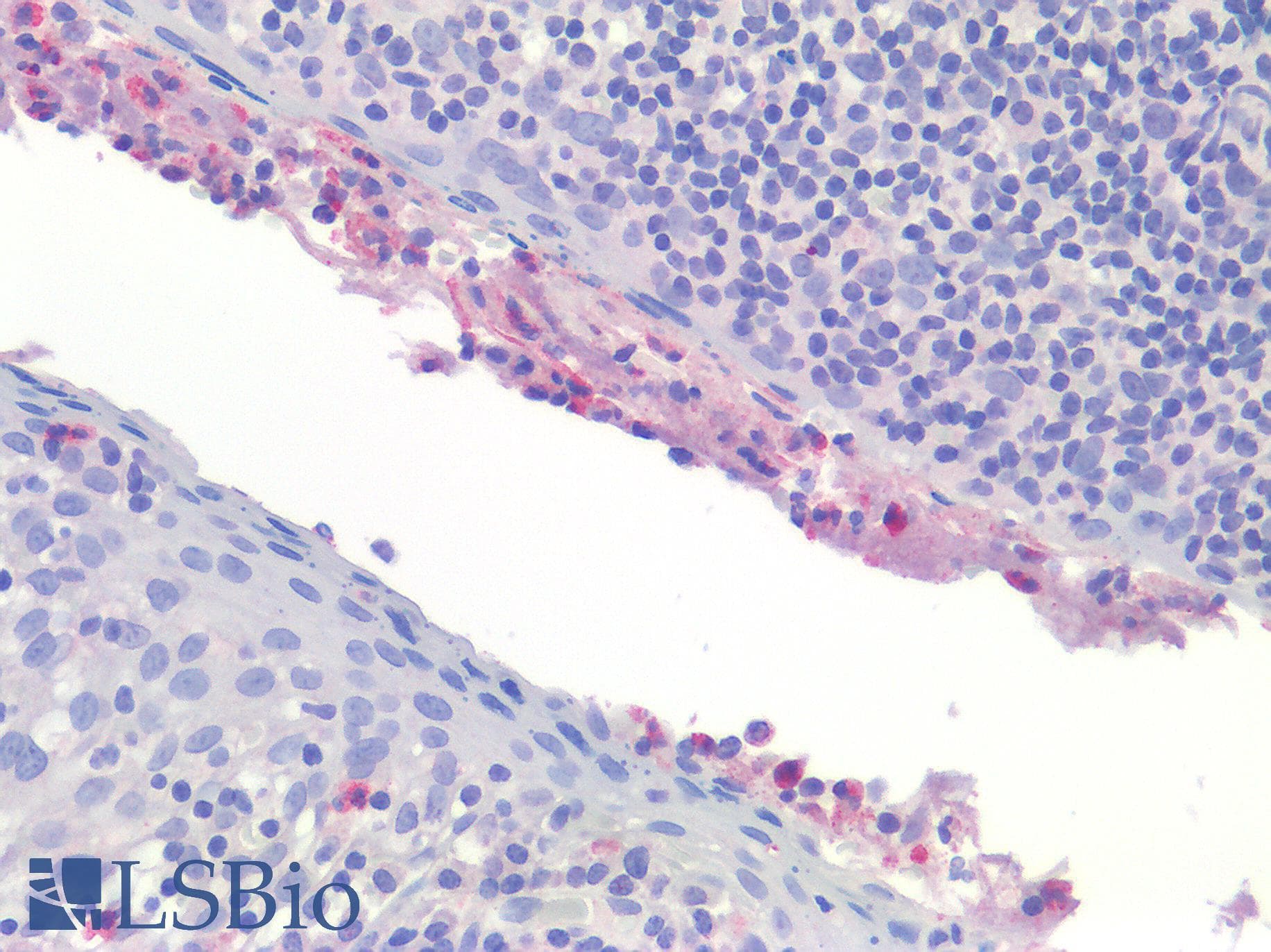 IHC-plus™ Polyclonal Rabbit anti-Human IL-1B / IL-1 Beta Antibody (IHC)