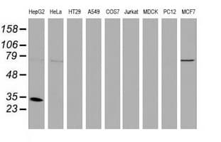 Monoclonal Mouse anti-Human SULT1A1 / Sulfotransferase 1A1 Antibody (clone OTI9B7, IHC, IF, WB)