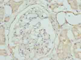 Polyclonal Rabbit anti-Human CLYBL Antibody (IHC, WB)