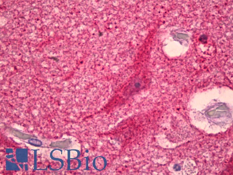 IHC-plus™ Polyclonal Rabbit anti-Human GPR151 Antibody (aa370-419, IHC, IF, WB)
