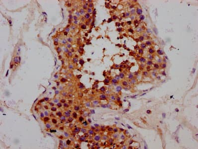 MEX3B / RKHD3 Antibody