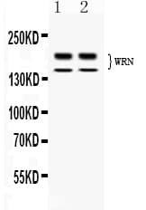Polyclonal Rabbit anti-Human WRN Antibody (WB)