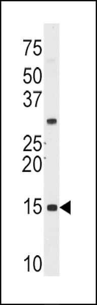 SNRPD1 / SMD1 Antibody (aa46-78)