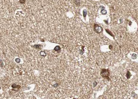 Polyclonal Rabbit anti-Human BDNF Antibody (IHC, IF, WB)