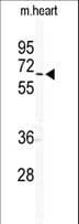 Polyclonal Rabbit anti-Human GJA9 / CX59 / Connexin 59 Antibody (aa484-515, IHC, WB)