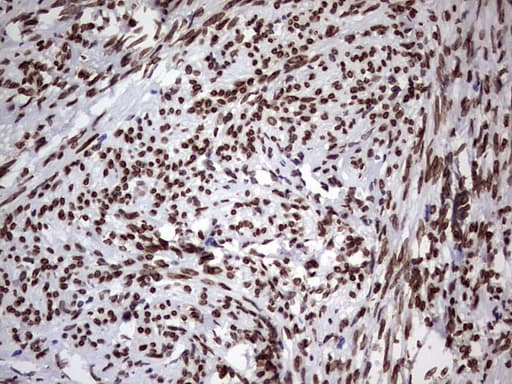 CSNK1E / CK1 Epsilon Antibody (aa153-416, clone OTI5D4)