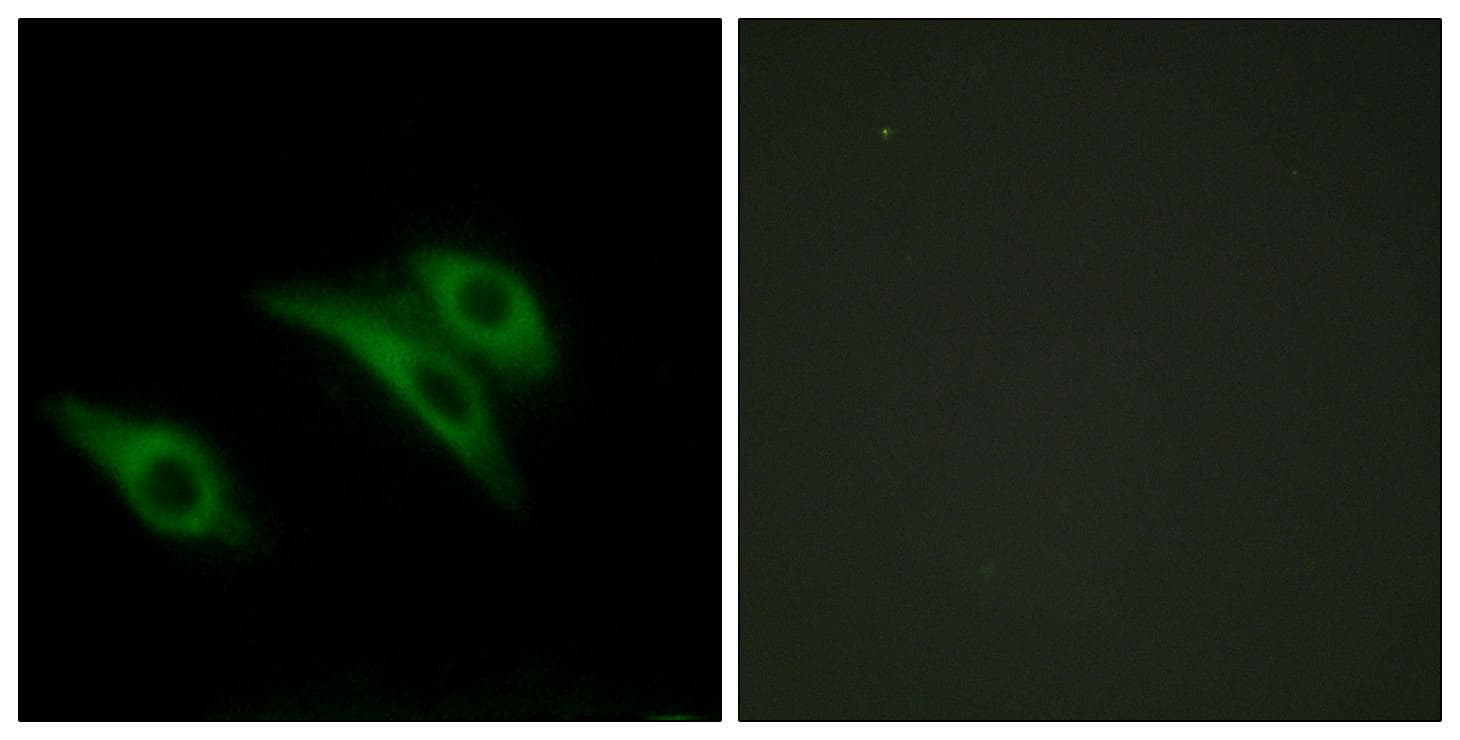 Polyclonal Rabbit anti-Human CD9 Antibody (IHC, IF, WB)