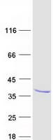 Human RASL12 Protein (Recombinant Myc-DDK (Flag))