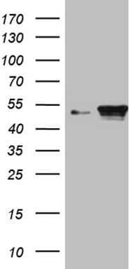 KRT18 / CK18 / Cytokeratin 18 Antibody (aa69-372, clone OTI10H8)