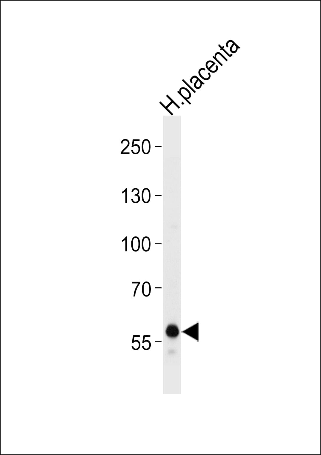 IHC-plus™ DAB2 Antibody (aa743-770)