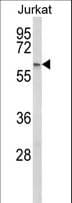 PCCB Antibody (aa82-107)