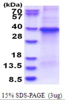 Human GNB1 Protein (Recombinant His)