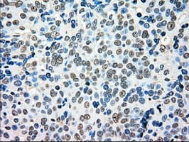 Monoclonal Mouse anti-Human MRI1 Antibody (clone OTI6G9, IHC, IF, WB)