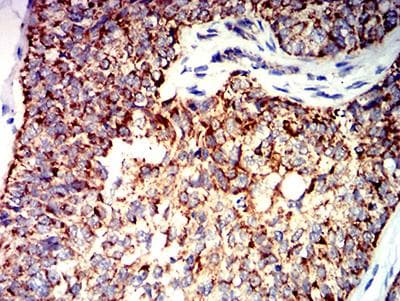 BAK1 / BAK Antibody (clone 2H9H7)