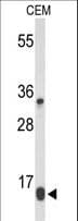 GBTS1 / DIRAS1 Antibody (aa109-136)