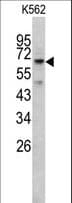 RIOK1 Antibody (aa126-156)