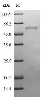Influenza A Virus Nucleocapsid Protein (Recombinant 6His, N-terminus)