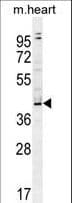 Polyclonal Rabbit anti-Human ZBTB42 Antibody (aa37-65, IHC, WB)