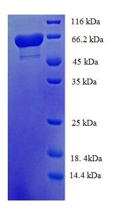 Human ALDH5A1 Protein (Recombinant His-SUMO)