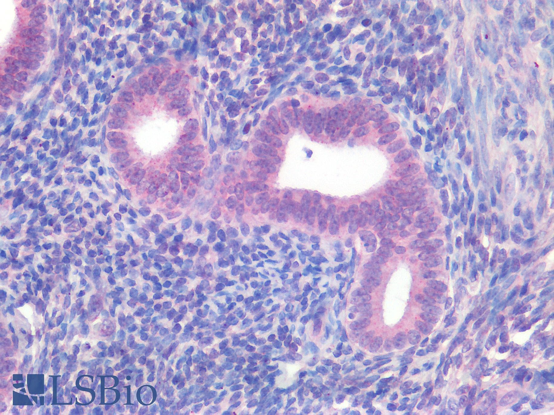IHC-plus™ CTNNB1 / Beta Catenin Antibody