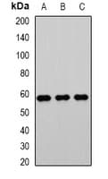 Polyclonal Rabbit anti-Human ACCS / ACS Antibody (IHC, IF, WB)