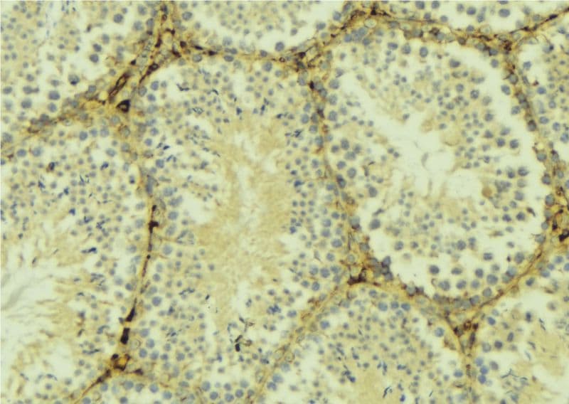 FZD6 / Frizzled 6 Antibody