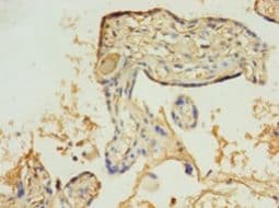 IHC-plus™ HBB / Hemoglobin Beta Antibody (aa1-147)