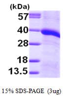Human MGLL / Monoacylglycerol Lipase Protein (Recombinant His)