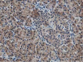 Monoclonal Mouse anti-Human ATG3 Antibody (clone OTI2C12, IHC, IF, WB)