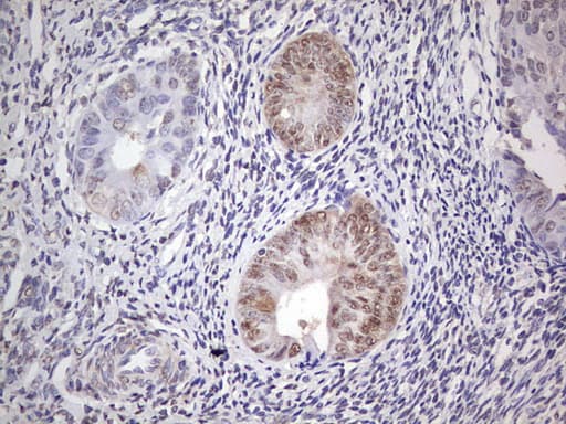 ER Alpha / Estrogen Receptor Antibody (aa1-310, clone OTI9E6)