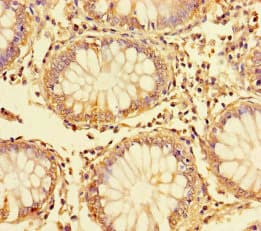 DDIT3 / CHOP Antibody