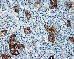 SRR / Serine Racemase Antibody (clone OTI2E3)