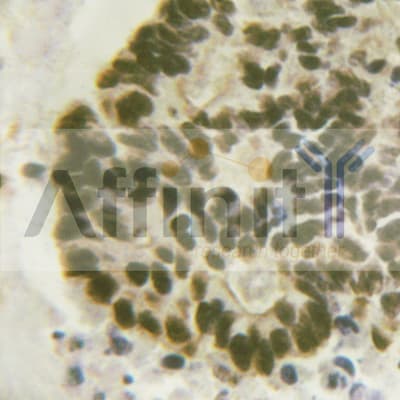 C/EBP Beta / CEBPB Antibody