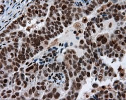 Monoclonal Mouse anti-Human ACLY / ATP Citrate Lyase Antibody (clone 3G8, Carrier-free, IHC, IF, WB)