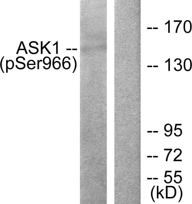 MAP3K5 / ASK1 Antibody (phospho-Ser966)