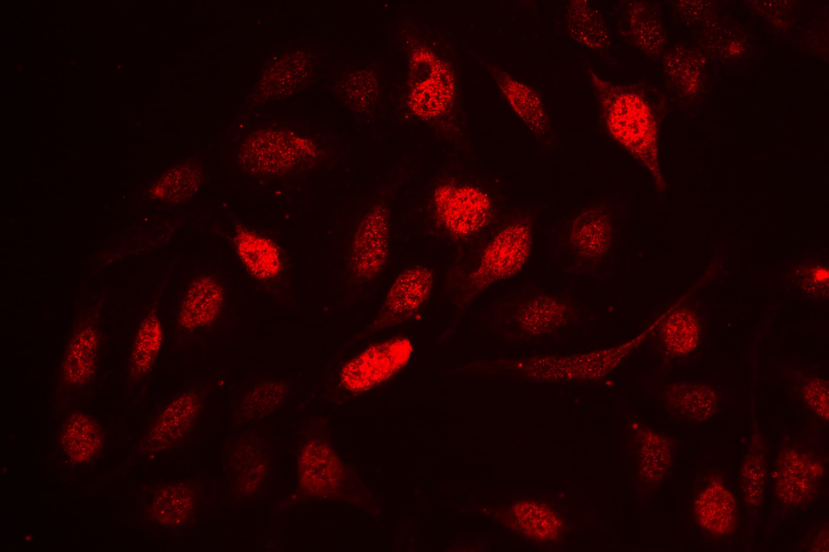 CCNA2 / Cyclin A2 Antibody (aa10-168)