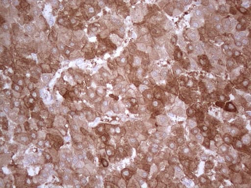 PPA2 Antibody (clone OTI7C1)