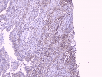 PEBP1 / RKIP Antibody