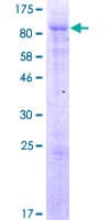Human ARFGAP2 / ZNF289 Protein (Recombinant GST)