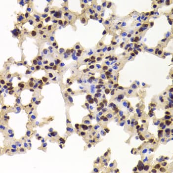 PPAT Antibody