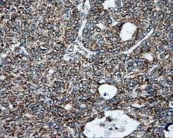 Monoclonal Mouse anti-Human BRAF / B-Raf Antibody (clone OTI1E2, IHC, IF, WB)
